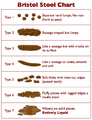 Feces on the two extremes of the Bristol stool chart usually make for the best Epic toilet stories.