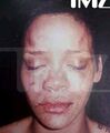 Rihanna aftermath