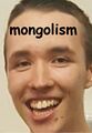 a genuine scientific specimen of a mongoloid idiot